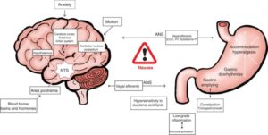 Functional nausea