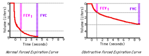 Obstructive ventilatory defect